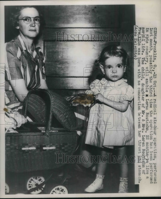 1949 Press Photo Radical six hour operation Lorna Routzahn - Historic Images