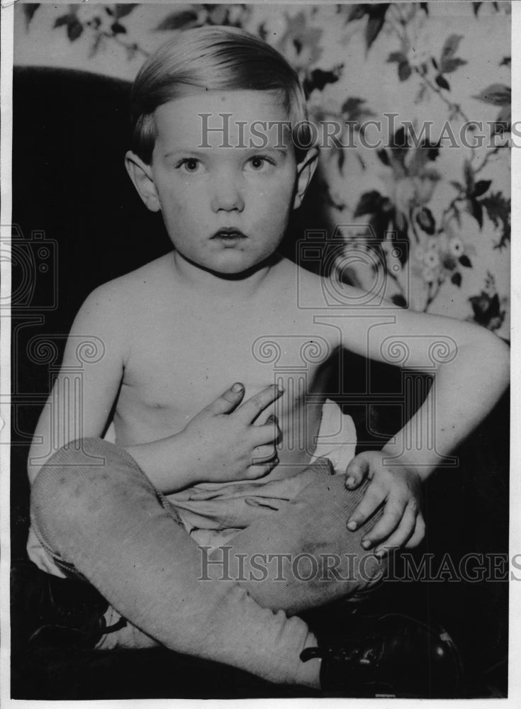 1933 3 Year Old Billy Jorgenson Swalled Mothers Watch - Historic Images