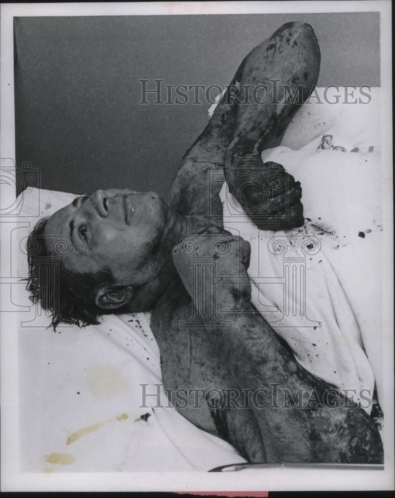 1970 Press Photo Unidentified Man Covered in Blood - Historic Images