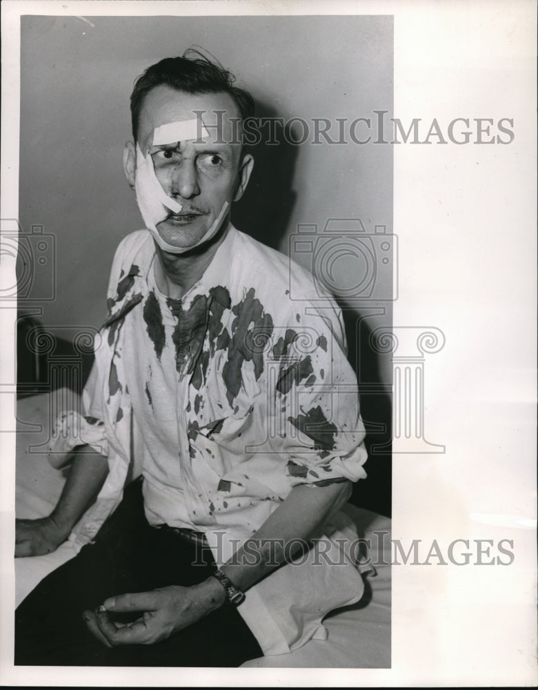 1953 Press Photo Carl Flickinger Injured After Underground Cleveland Blast - Historic Images