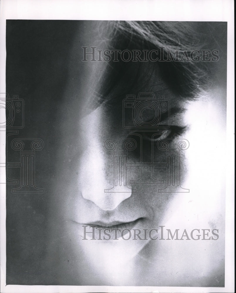 1962 Press Photo Retinal Damage, loss of part of vision - nec65620 - Historic Images