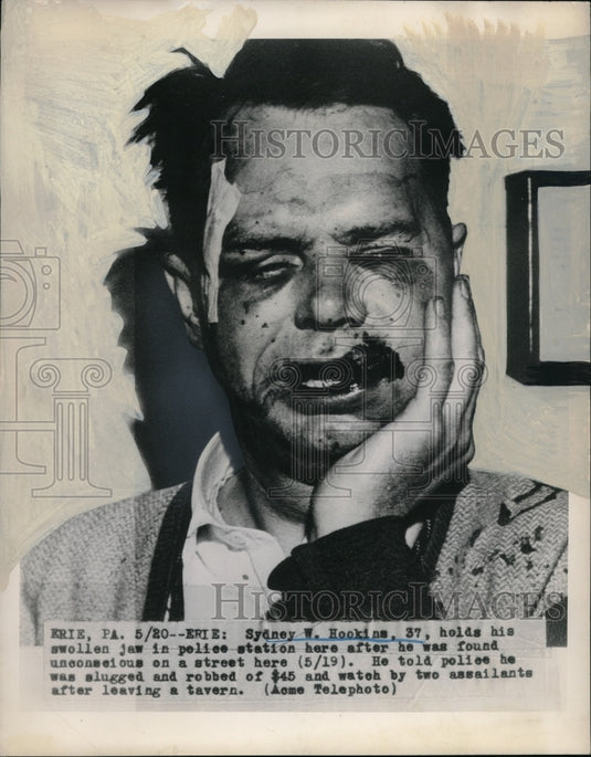 1948 Press Photo Erie, Pa Sydney Hookins after being beaten & robbed - nec68125 - Historic Images