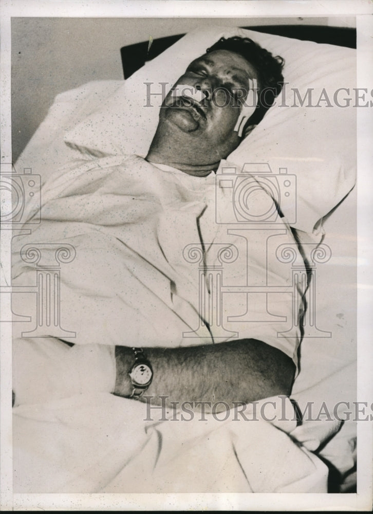 1937 Press Photo Detective Thomas Washburn, LA, Calif in hospital beaten - Historic Images