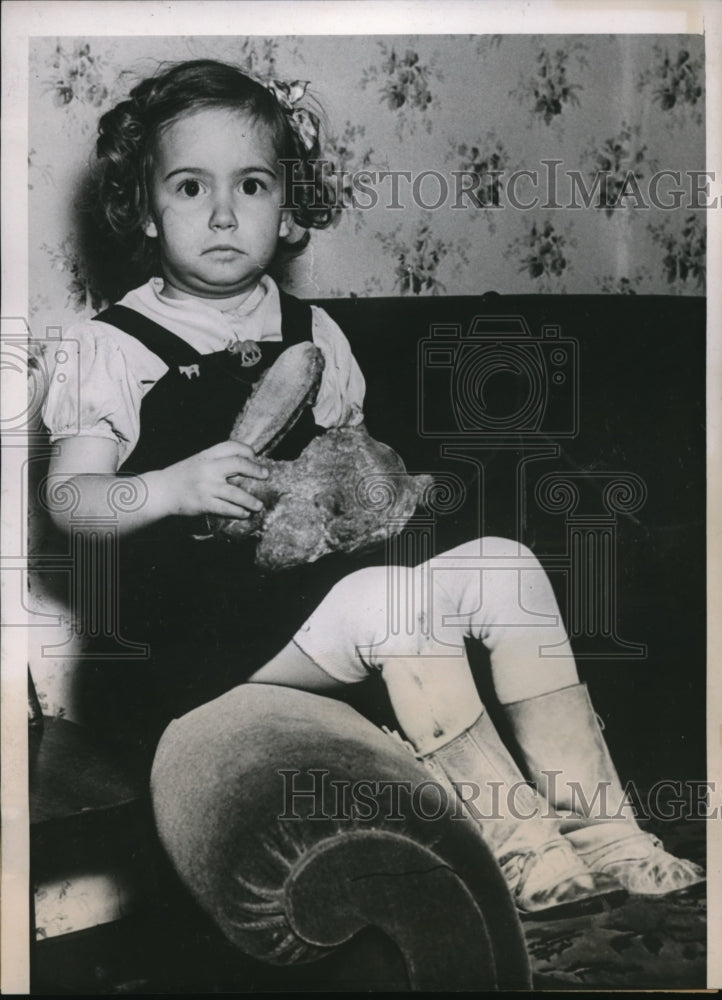 1938 Press Photo After picture of Charlotte Shafer&#39;s scar from accident - Historic Images