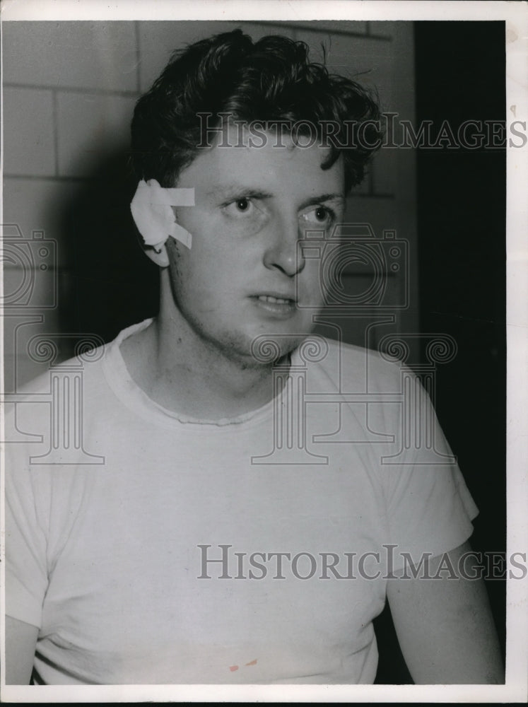 1953 Press Photo Ed O&#39;Malley victim of a glass window hitting him - Historic Images