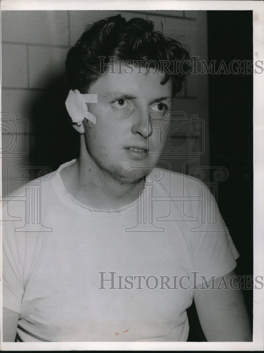 1953 Press Photo Ed O'Malley victim of a glass window hitting him - Historic Images