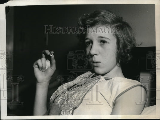 1933 Press Photo Dr. Shumaker remove a penny whistle from H. Holcombe's throat-Historic Images