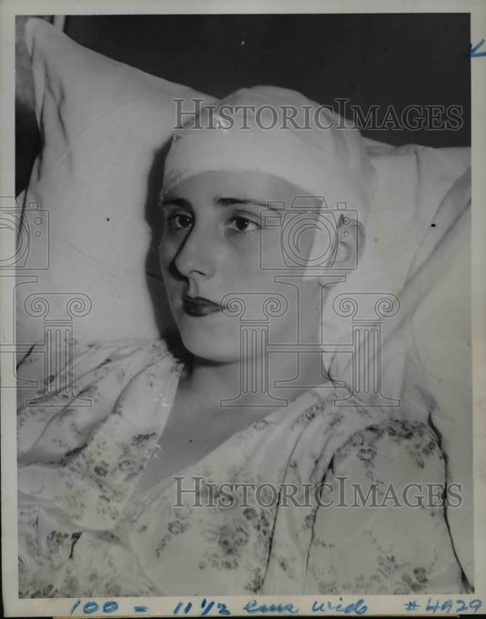 1944 Press Photo Mrs. Margaret Eagen with her scalp replaced after an accident - Historic Images