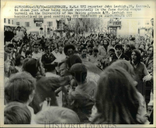 1970 John Leahigh shown just after being struck repeatedly-Historic Images