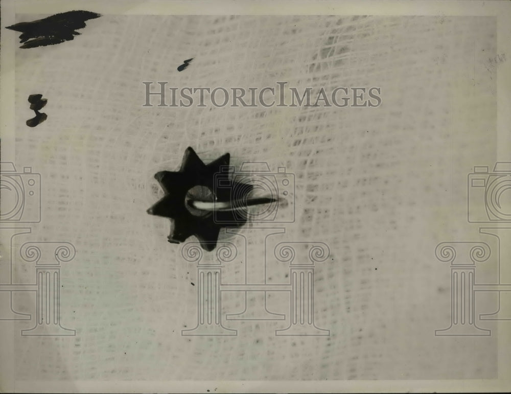 1927 Press Photo Pin swallowed by Roland Westbrook of Waverly, Va. - Historic Images