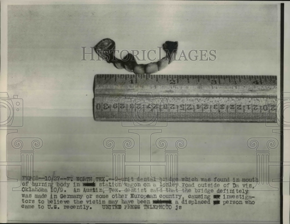 1954 Press Photo Dental bridge found in mouth of burning body - Historic Images