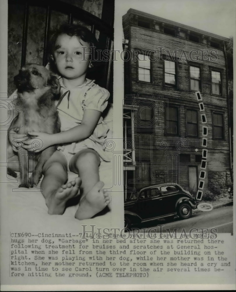 1951 Press Photo Carol Ann McMains After Treatment at Hospital - Historic Images