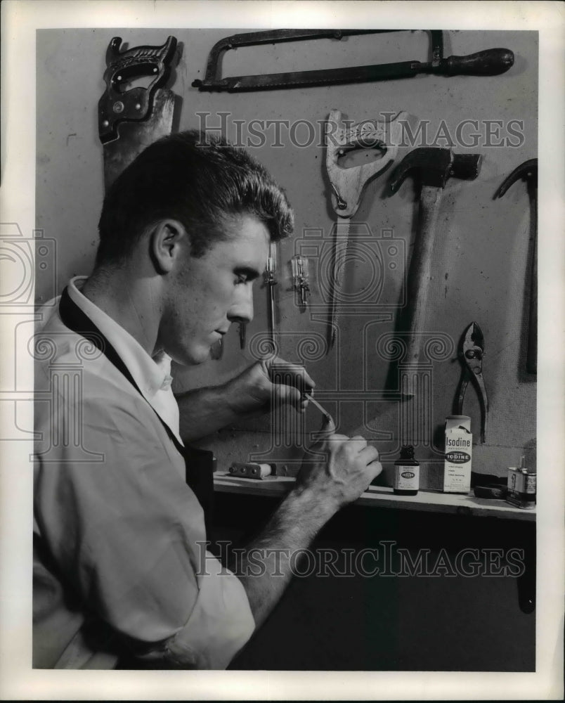 1956 Press Photo Taking care of cut or bruise with Iodine at Workshop - Historic Images