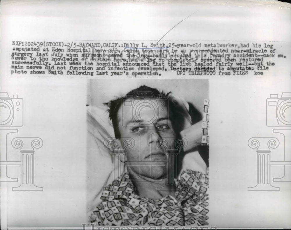 1960 Press Photo Recovering California Foundry Accident Victim Billy L. Smith - Historic Images