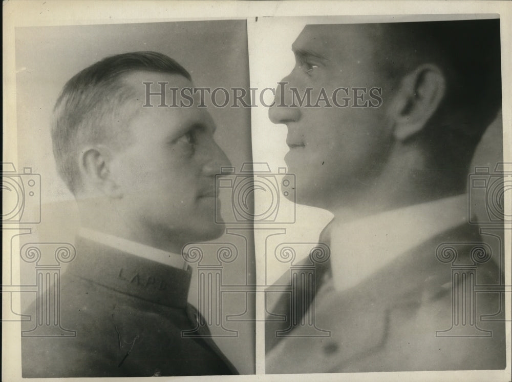 1925 Press Photo William H. Stiles and his before and after photo. - Historic Images