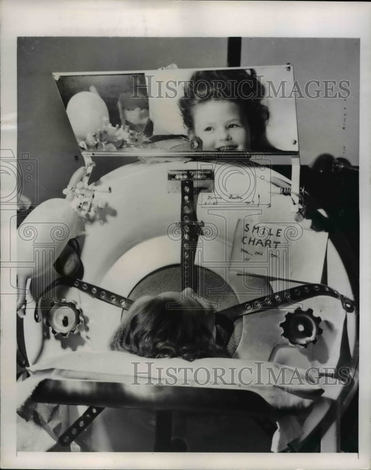 1949 Norma Gaston, Polio Patient Fights the Disease with Smiles - Historic Images