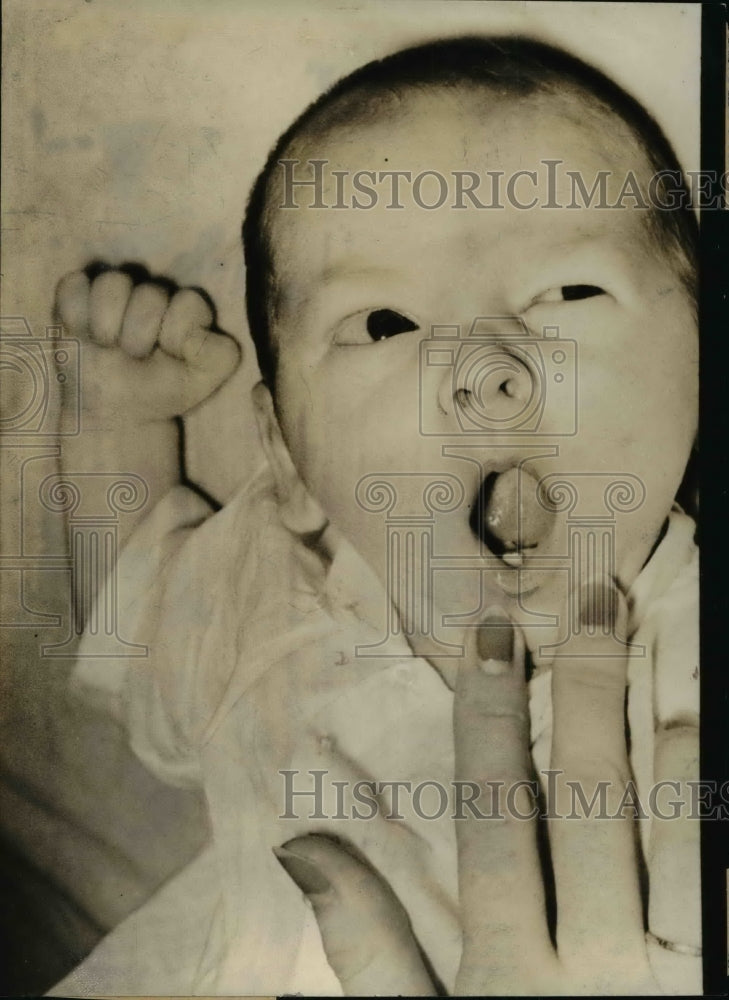 1939 Baby Raymond Dean Kimbrell, Born w one Tooth  - Historic Images