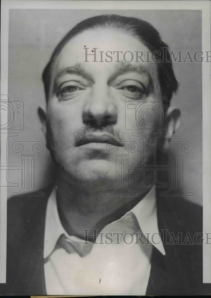 1939 Press Photo Isadore Edelstein, United Airlines Plane Crash Survivor - Historic Images