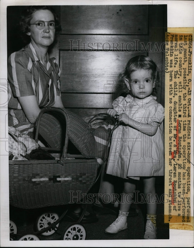 1949 Press Photo Lorna Routzahn age 22 months had radical operation - nem31584-Historic Images