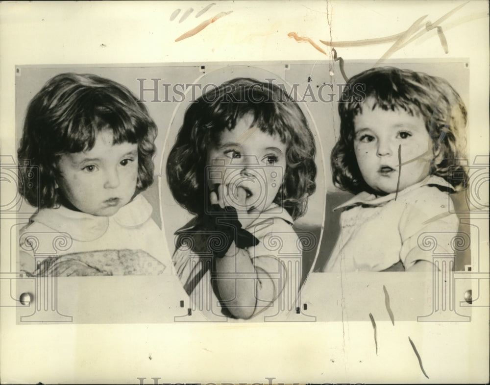 1933 Press Photo New York Helen Vasco eye victim child need operation NYC - Historic Images