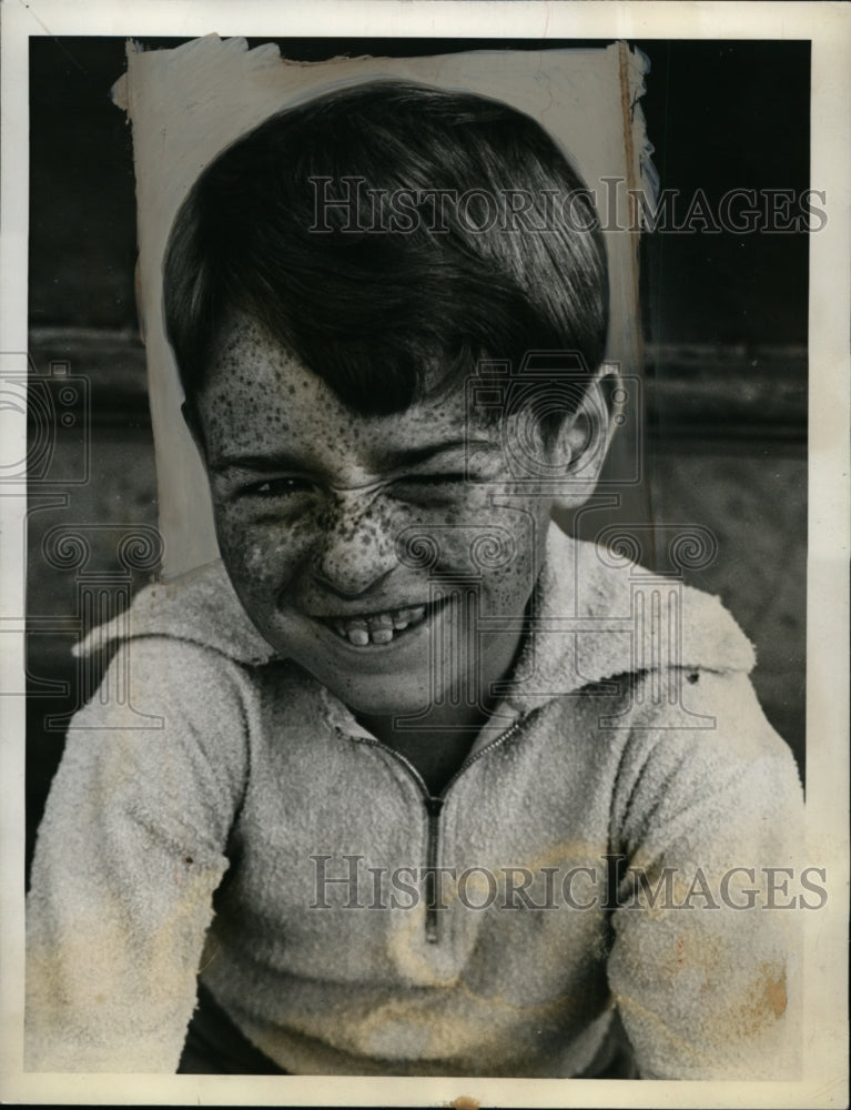 1938 David David of Toronto, Ontario, Entrant in Freckles Contest - Historic Images