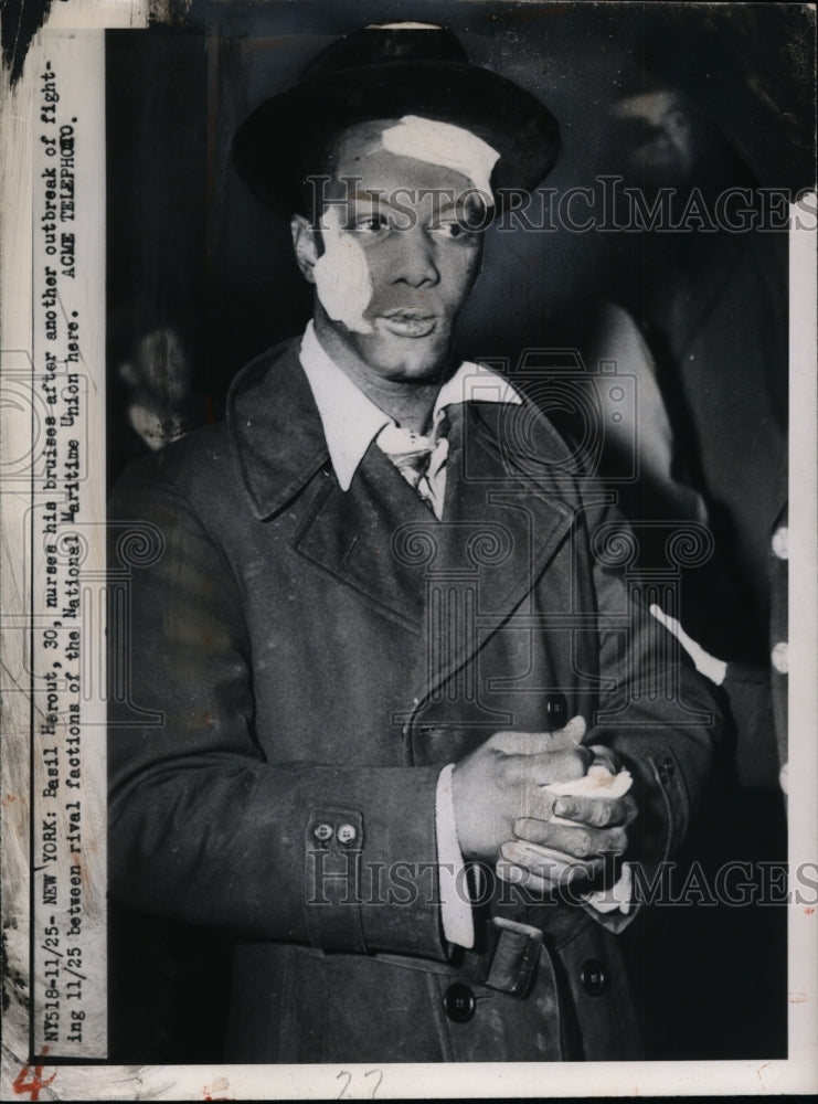 1949 Basil Harout, Injured in National Maritime Union Fighting, NYC - Historic Images