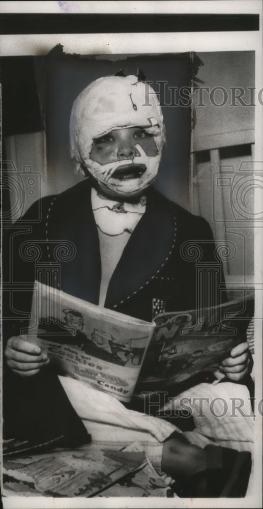 1954 Herman Long recovering from surgery after firecracker accident - Historic Images