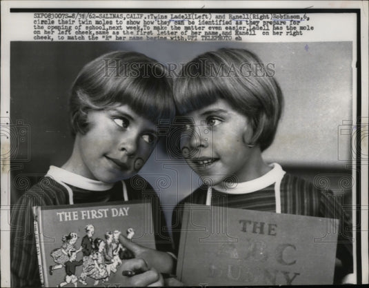1962 Press Photo Twins Ladell & Ranell Robinson with Moles Circled, California-Historic Images