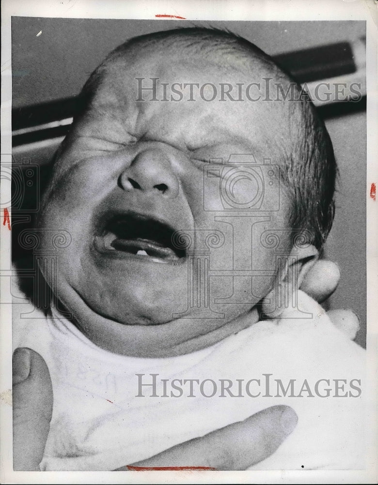 1957 Press Photo One Week Old Baby Born with Tooth - Historic Images