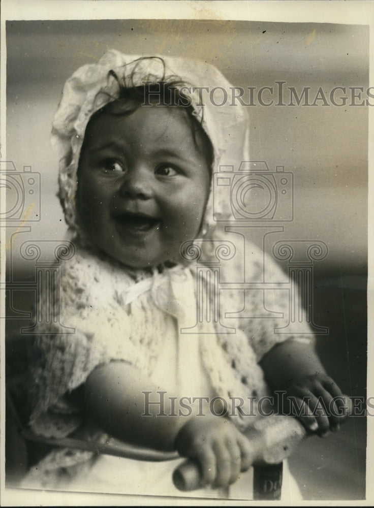 1928 Press Photo Betty Lou Spoo baby in Oakland Cal hospital swallowed  pin - Historic Images