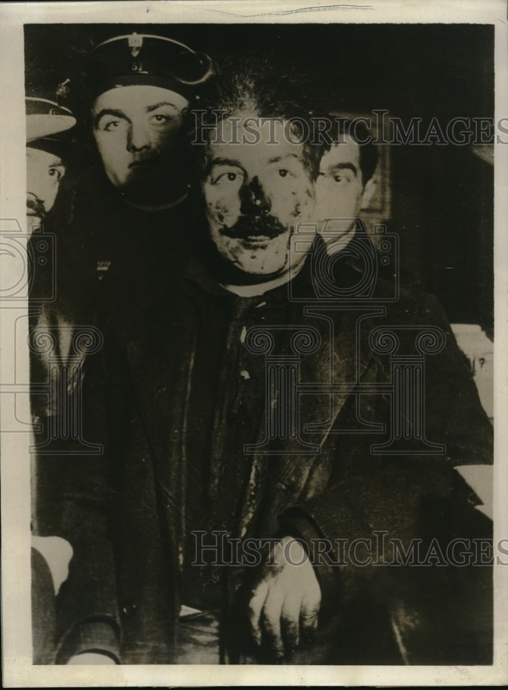 1930 Press Photo Ramichivili Attempted Assassin Tchaneuk Parmeny Beat by Mob - Historic Images