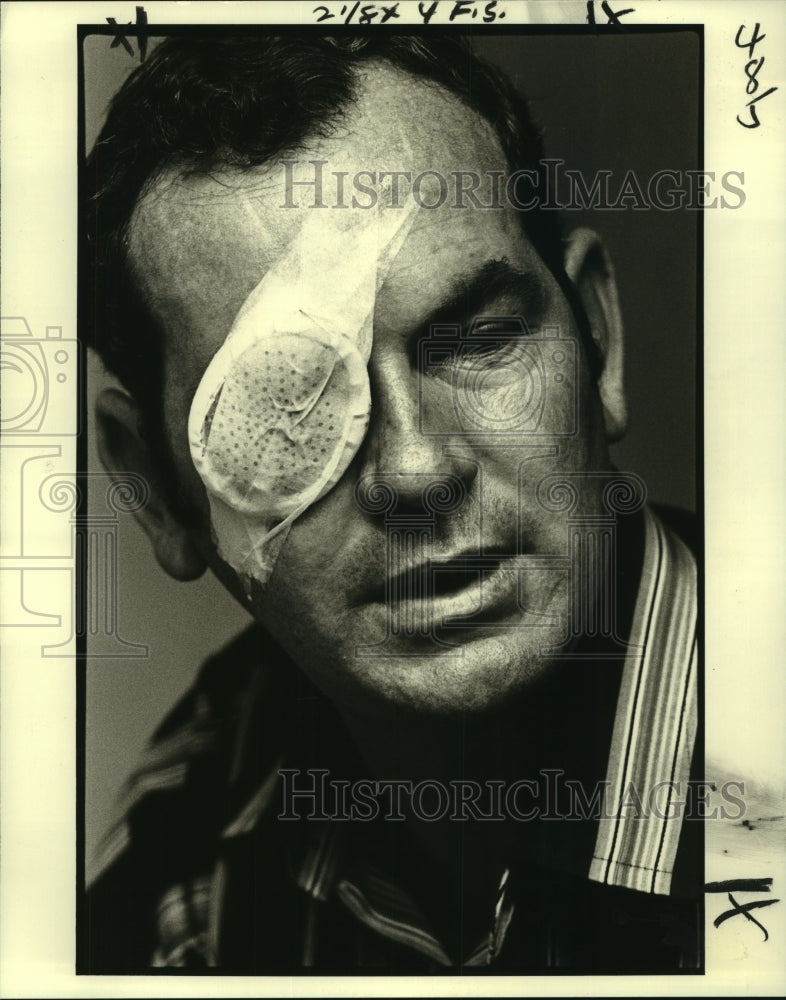 1980 Press Photo Legally Blind Man Colin Druery After Having a Cornea Transplant - Historic Images