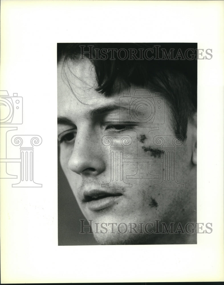 1994 Press Photo Paul Goodson with stitches after pistol whipped by N.O. Police - Historic Images