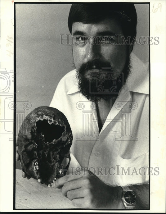 1981 Press Photo Dr. Christopher Goodwin studies skull found in canal - Historic Images