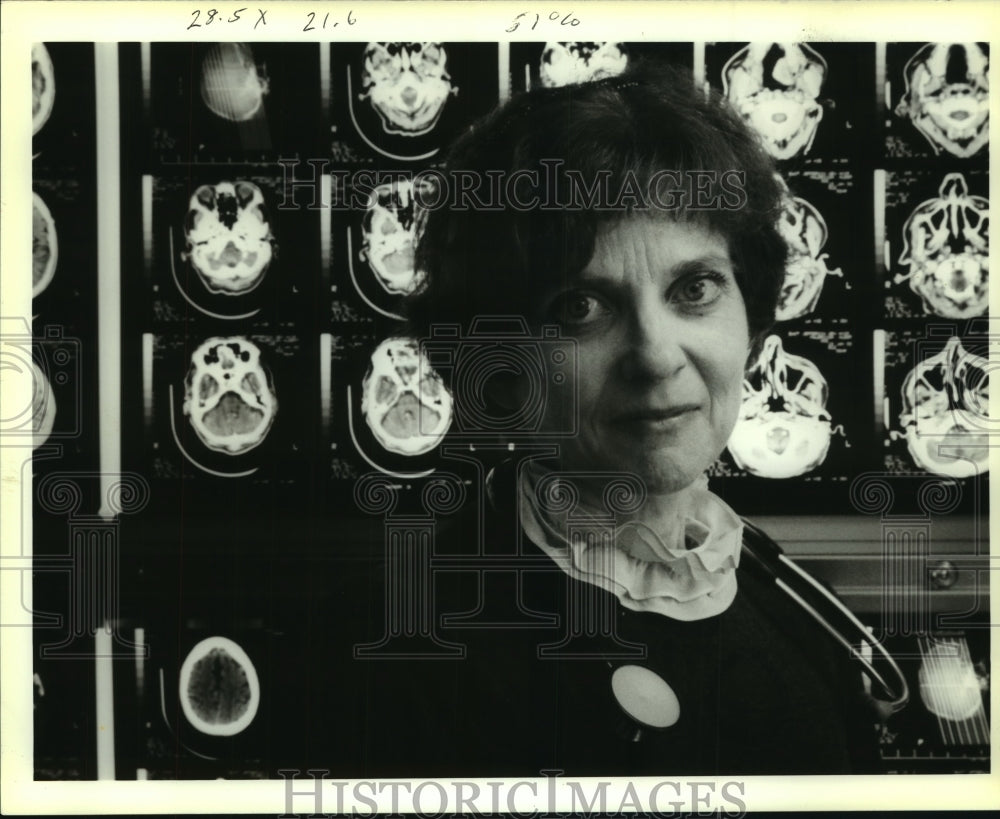 1993 Press Photo Cancer specialist Dr. Jayne Gurtler, with CAT scan photographs - Historic Images