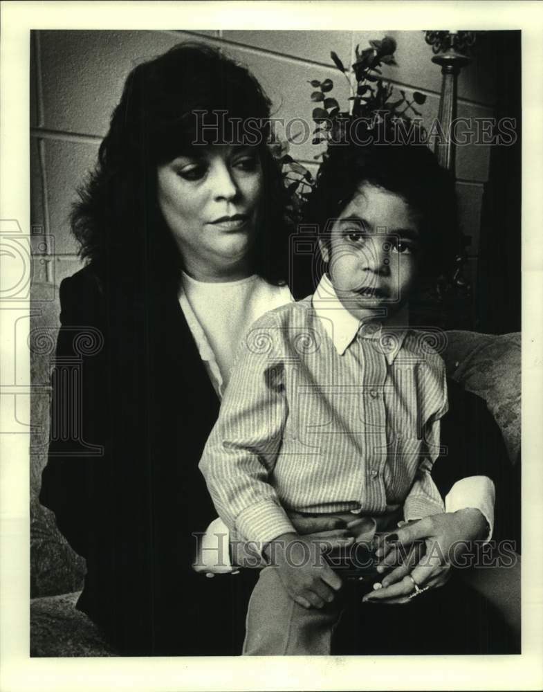 1984 Press Photo Sharon Stangl and Son Jared, with Elephant Man Disease- Historic Images