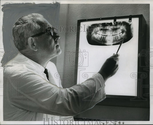 1970 Press Photo Dr. Raymond Boudreaux shows tooth for transplant project - Historic Images