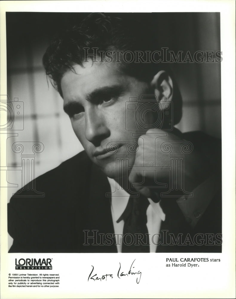 1991 Paul Carafotes stars as Harold Dyer, "Knots Landing" - Historic Images