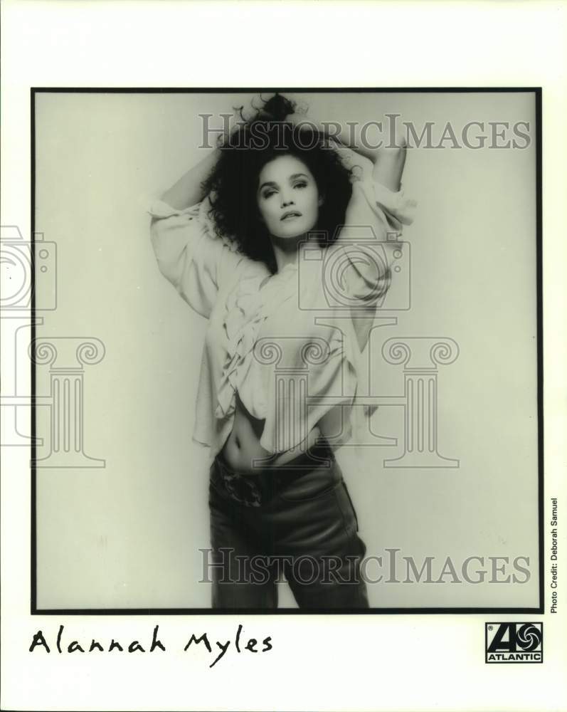 1995 Press Photo Alannah Myles, Singer - Historic Images