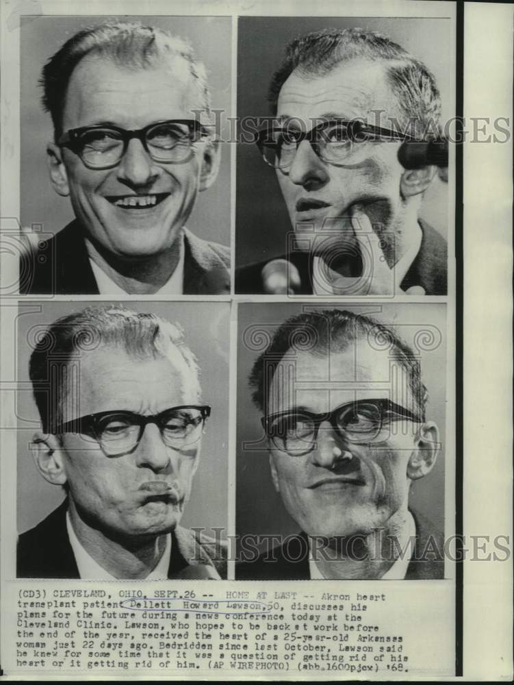 1968 Press Photo Heart plant patient Dellett Lawson at Cleveland news conference - Historic Images