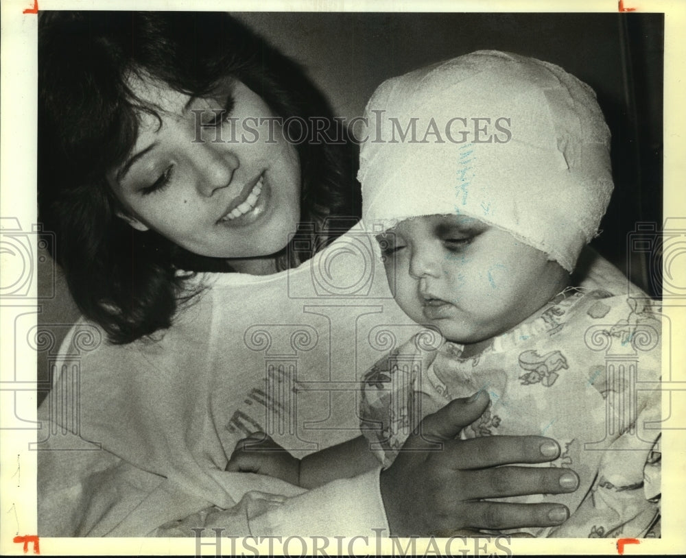 1982 Mary Ann and Priscella Ann Andrade after skull surgery - Historic Images