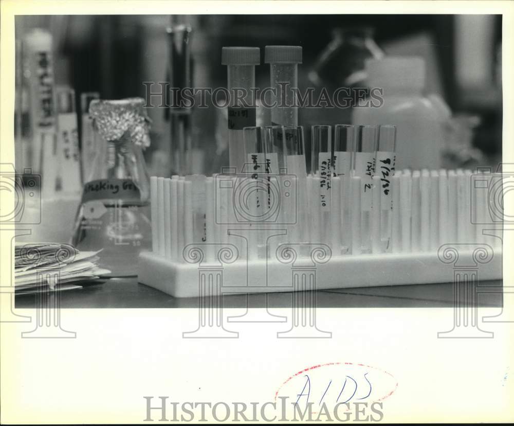 1987 Beakers And Test Tubes Used In AIDS Research Lab-Historic Images