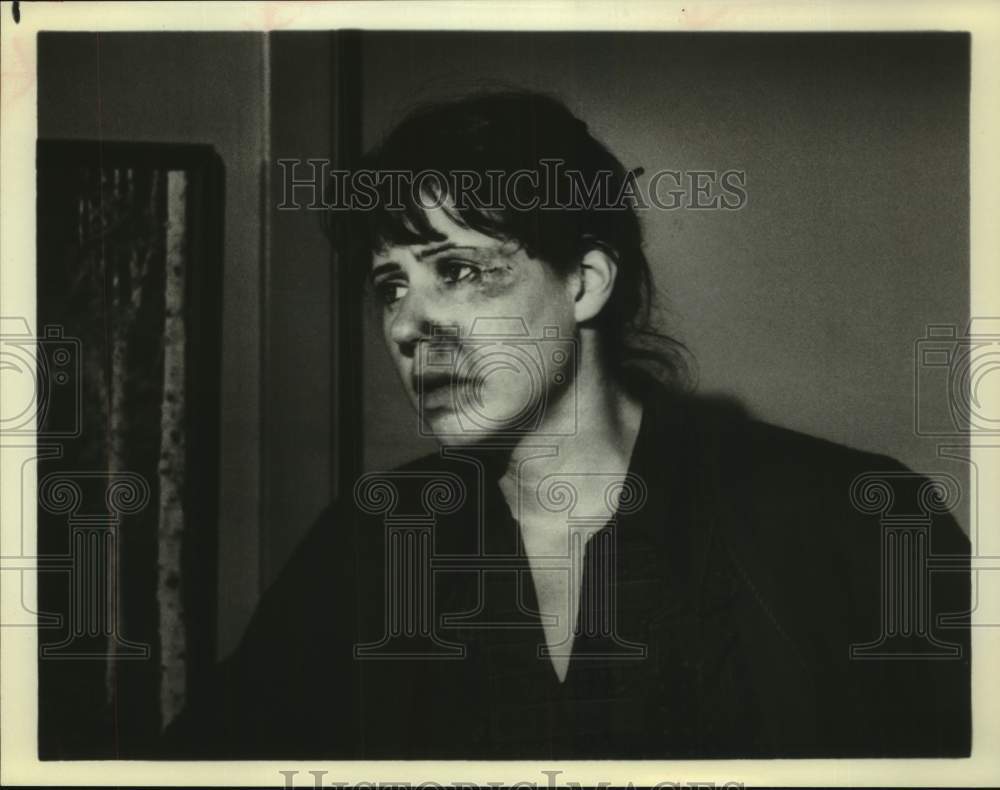 Press Photo Actress Julie Kavner in scene of movie with beat-up face - Historic Images