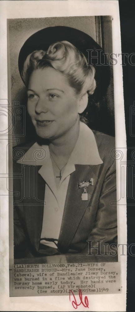 1949 Press Photo Mrs. Jane Dorsey burned in a fire which destroyed Dorsey Home. - Historic Images