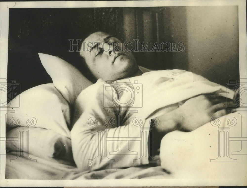 1929 Press Photo Charles Howe at Johns Hopkins Hospital After Nose Surgery - Historic Images