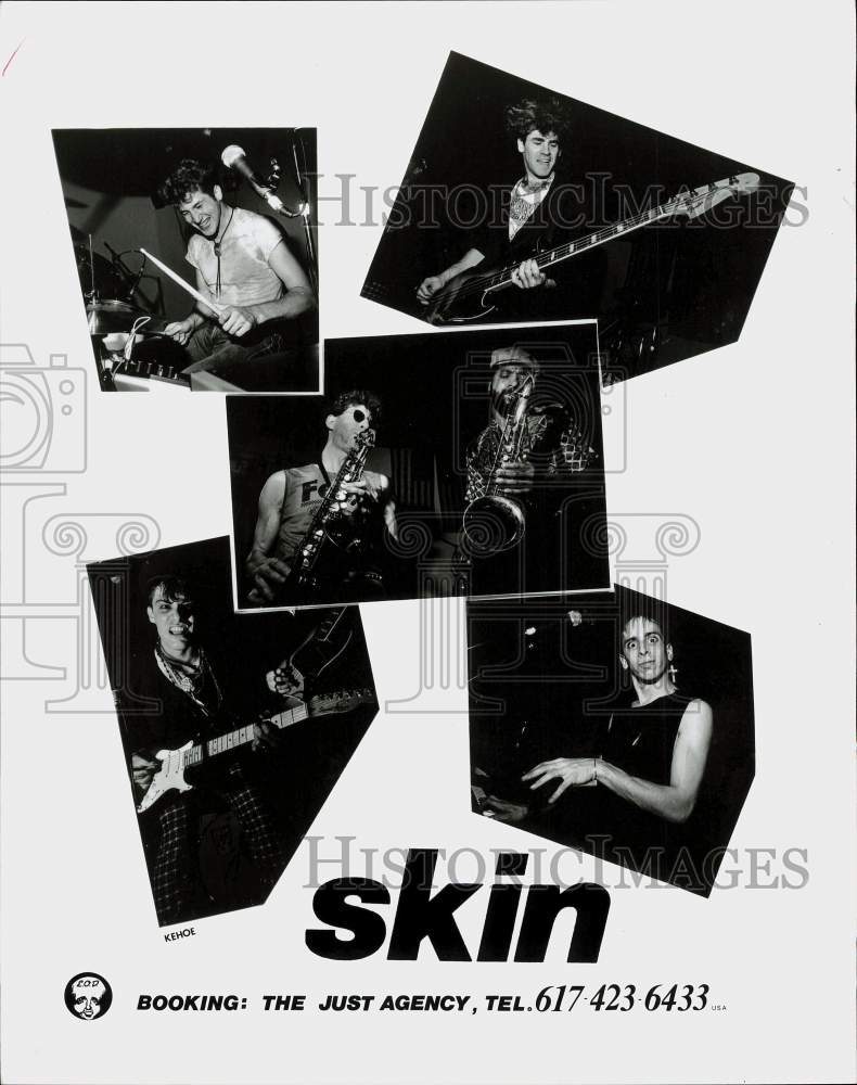 Press Photo Skin, Music Group - srp00457 - Historic Images